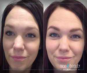 Auftritt der Augenbrauen