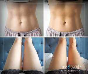 Bruin worden tijdens het slapen?