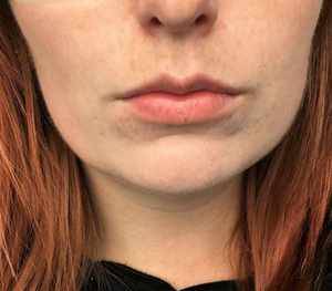 Slut med tørre læber