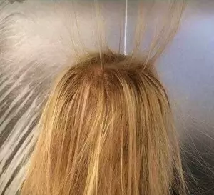 Elektrisk hår - hvad gør jeg?