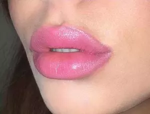 Fyldige læber uden fillers