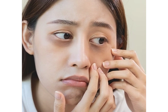 Træt af poser under øjnene?