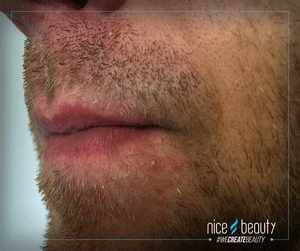 10 mythes over puistjes