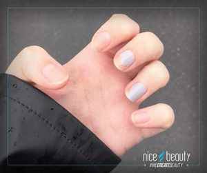 Nagellak: Problemen en Oplossingen