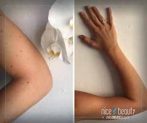 Sommerkulør med god samvittighed