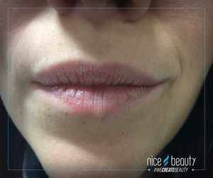 Undgå at få tørre læber i de kolde måneder!