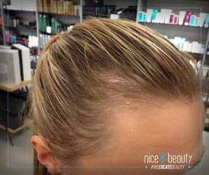 So vermeidest du fettiges Haar